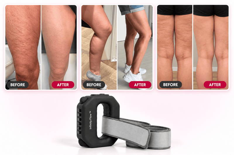 7 reasons women are draining inches off their swollen tree trunk legs in 30 days